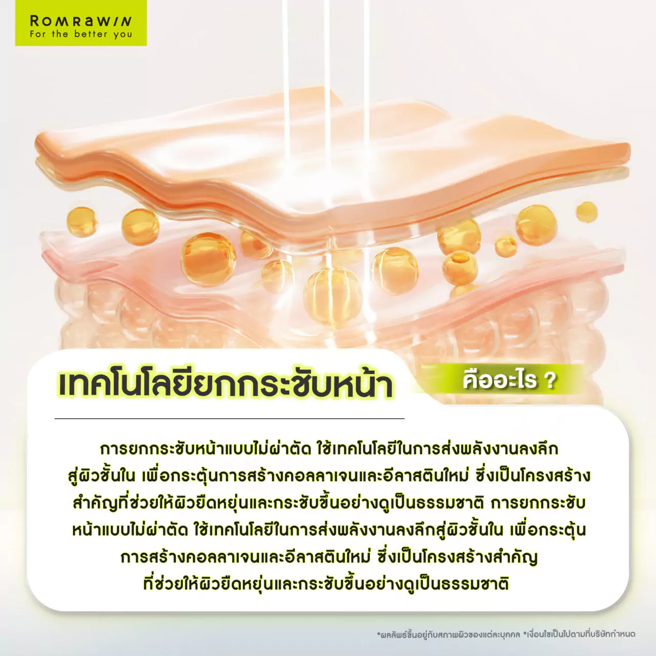 เทคโนโลยียกกระชับหน้าคืออะไร? วิธีคืนความกระชับให้ผิว ทางเลือกแบบไม่ผ่าตัด