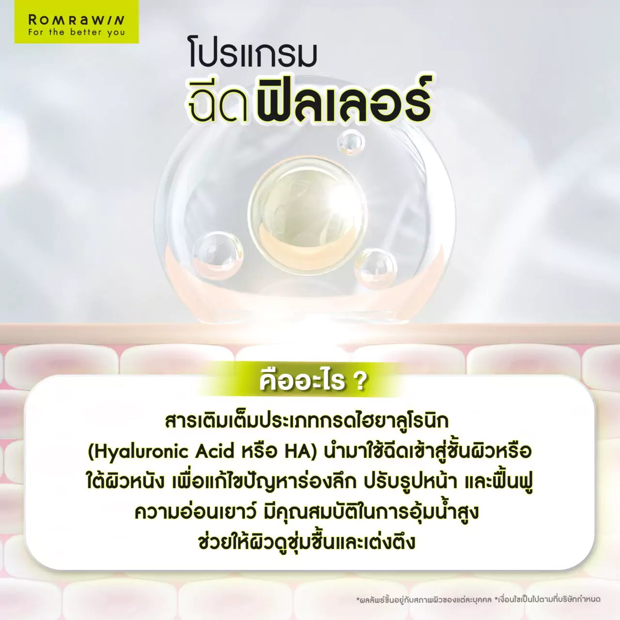 โปรแกรมฉีดฟิลเลอร์คืออะไร? เติมเต็มผิวแบบเร่งด่วนเพื่อความอ่อนเยาว์
