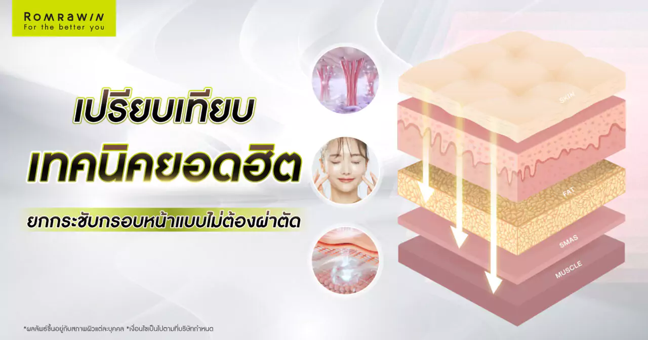 ยกกระชับกรอบหน้าแบบไม่ต้องผ่าตัด วิธีไหนดี?