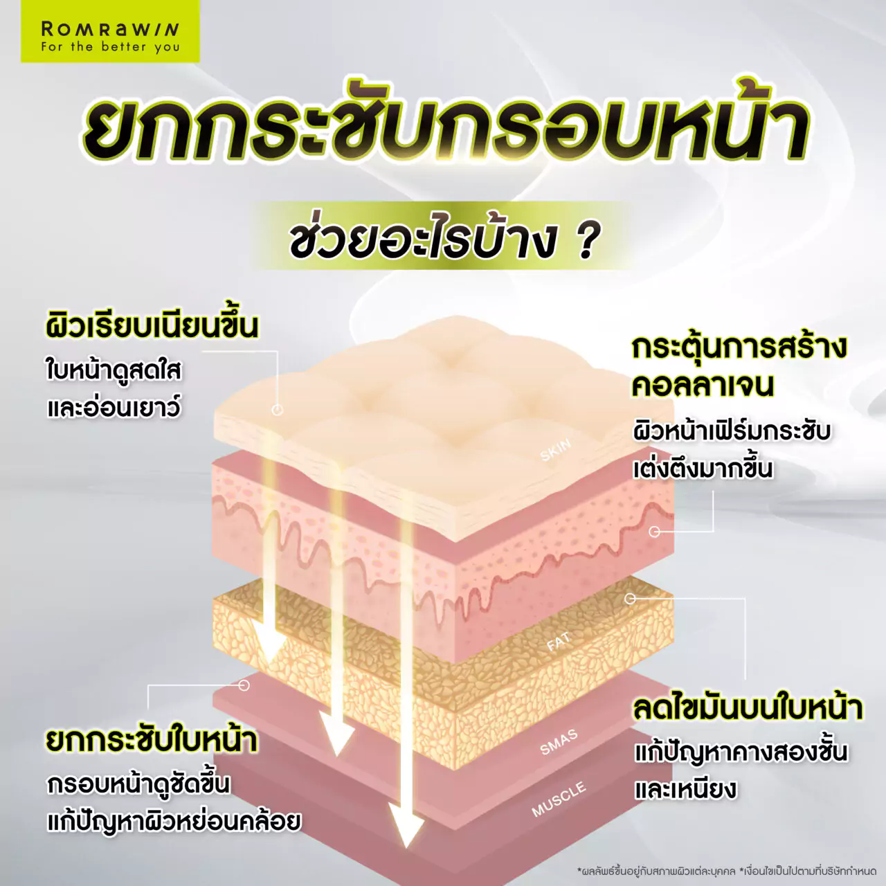 ยกกระชับกรอบหน้าแบบไม่ต้องผ่าตัด วิธีไหนดี? 4 ยกกระชับกรอบหน้าแบบไม่ต้องผ่าตัด ช่วยอะไรบ้าง?