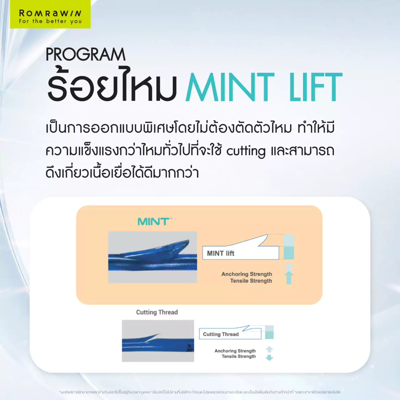 ไหม MINT Lift ไหมยกกระชับ ที่มอบผลลัพธ์การยกกระชับได้อย่างน่าพึงพอใจ 4 ร้อยไหม MINT Lift