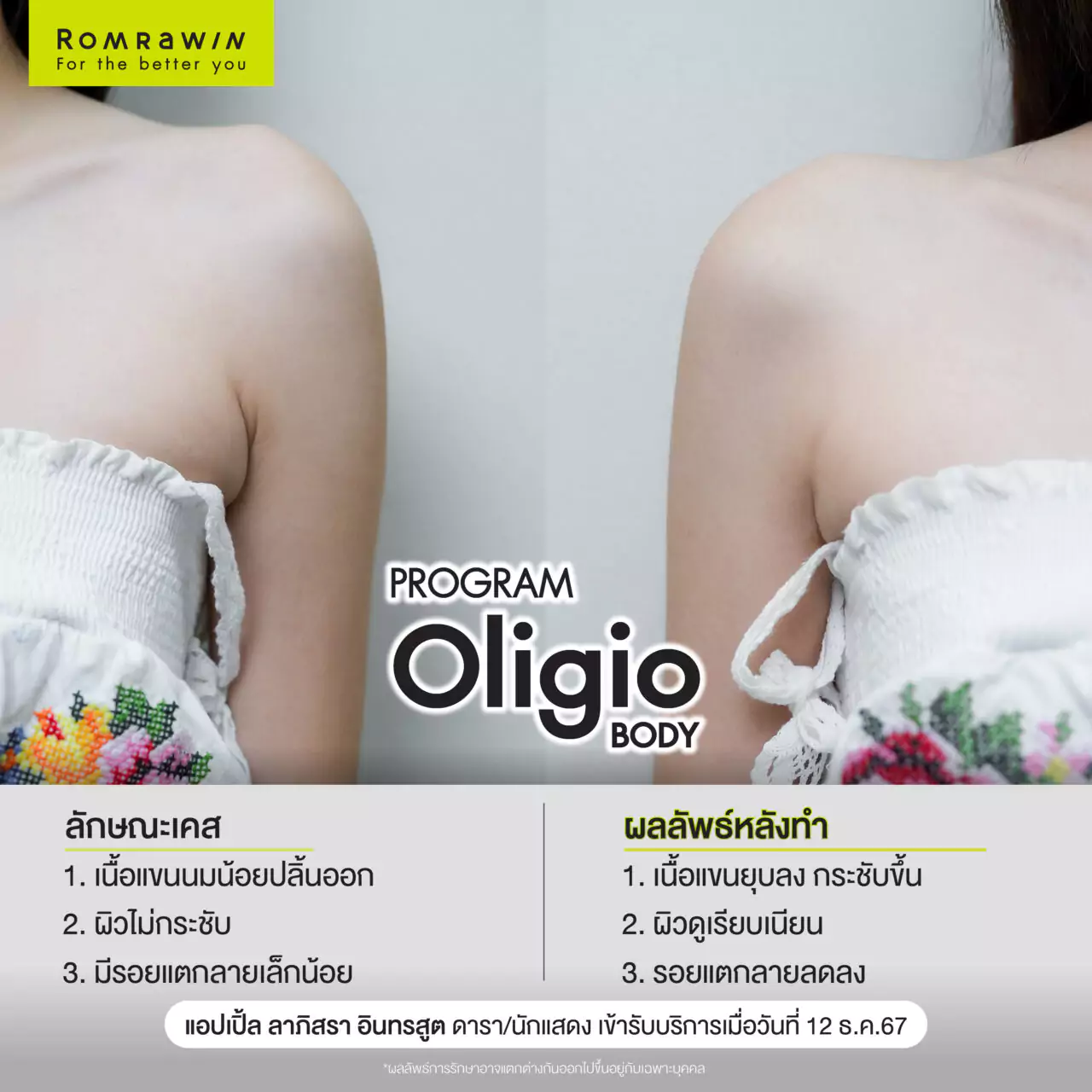 Oligio Body เลิกปลิ้น เปลี่ยนหุ่นให้เชพดี คุณแอปเปิ้ล ลาภิสรา