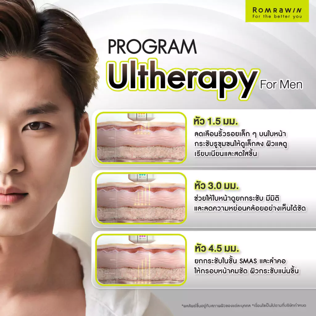 ยกกระชับผิว Ultherapy For Men คืออะไร?