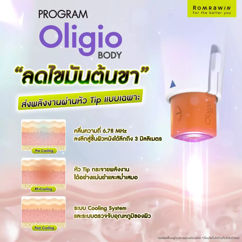 ลดไขมันต้นขาด้วย Oligio Body ส่งพลังงานผ่านหัว Tip แบบเฉพาะ