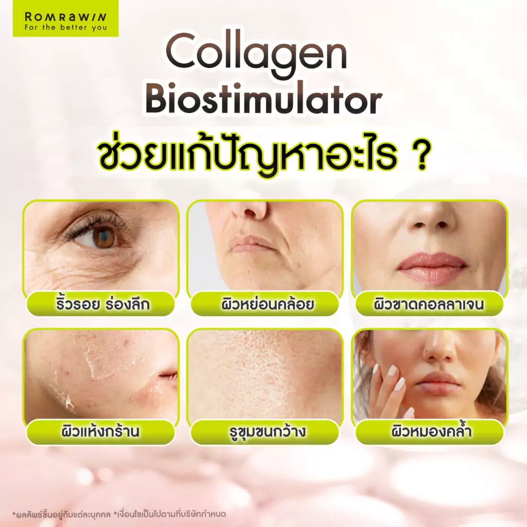 Collagen Biostimulator สารกระตุ้นคอลลาเจน ช่วยแก้ปัญหาอะไร?