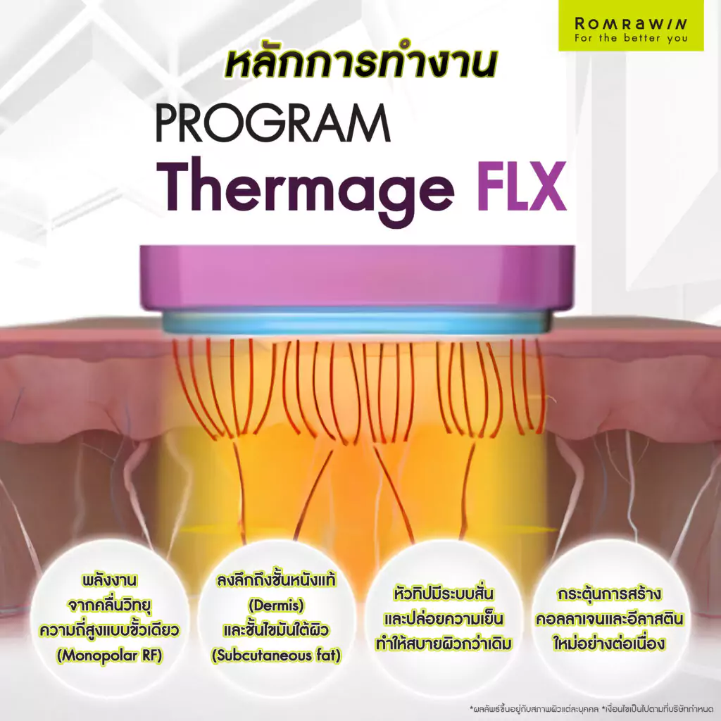 หลักการทำงานของ Thermage FLX โปรแกรมผิวหน้าตึงกระชับ