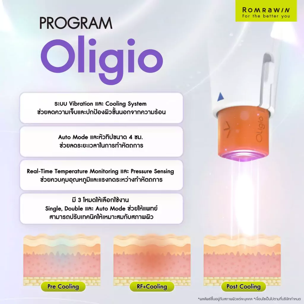 ทำความรู้จักกับ Oligio 