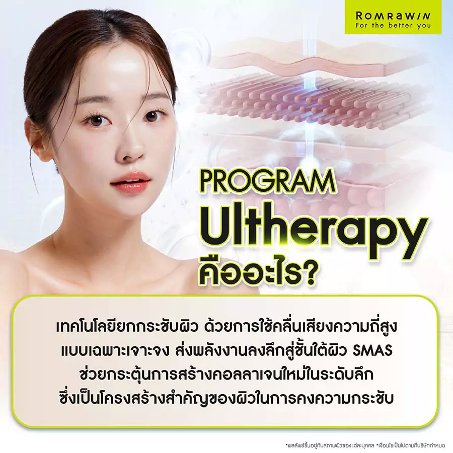 Ultherapy (อัลเทอราปี) คืออะไร?
