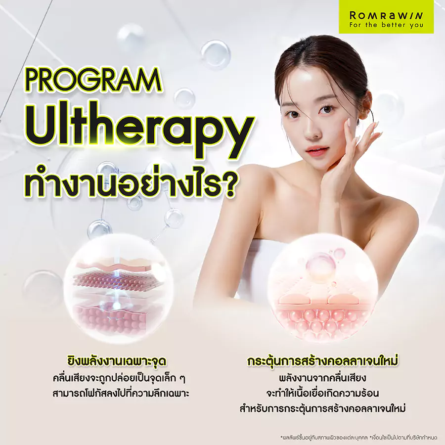 Ultherapy (อัลเทอราปี) ทำงานอย่างไร?