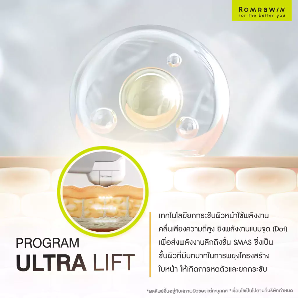 Ultra Lift คืออะไร?