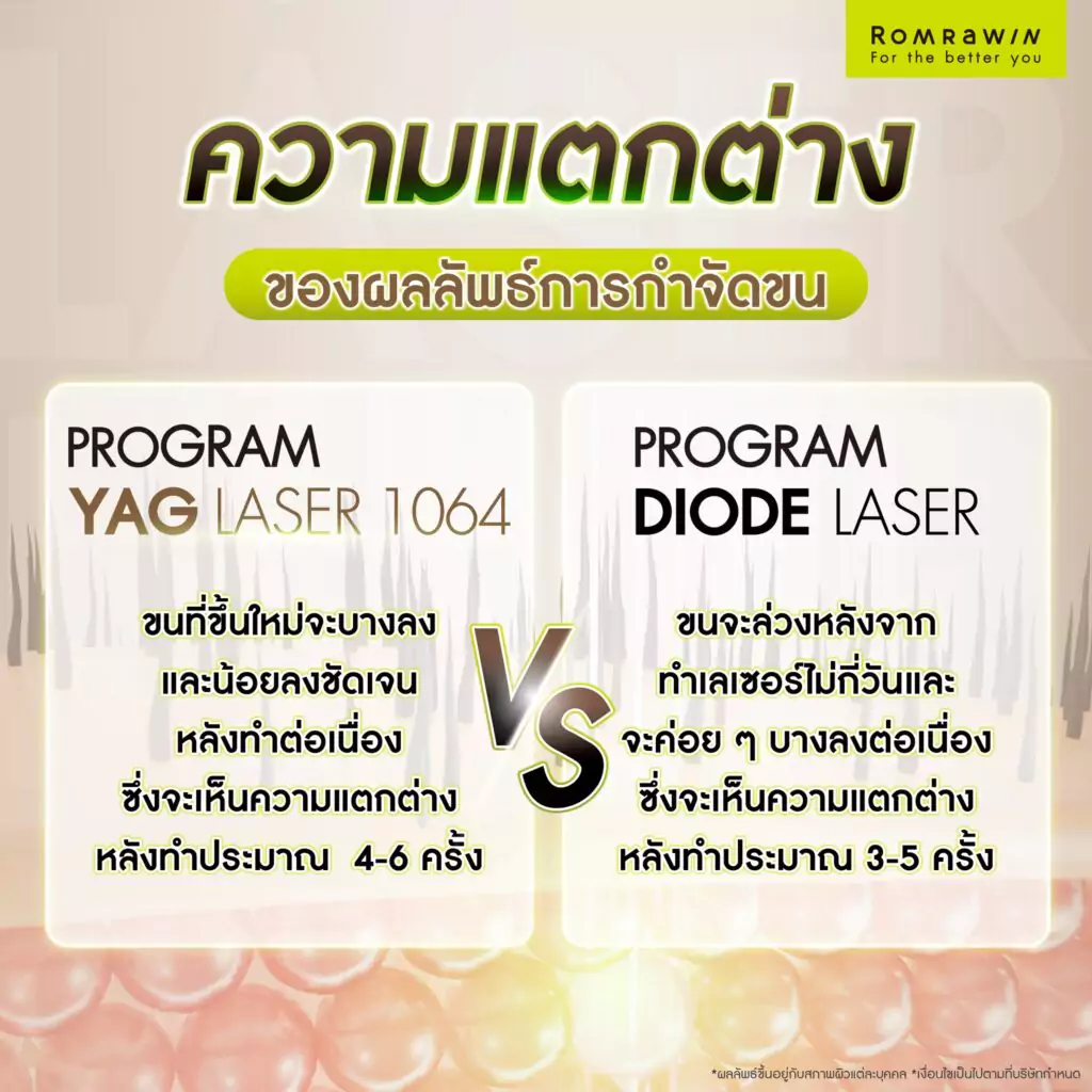 ผลลัพธ์การกำจัดขนของ YAG Laser กับ Diode Laser ต่างกันไหม ?