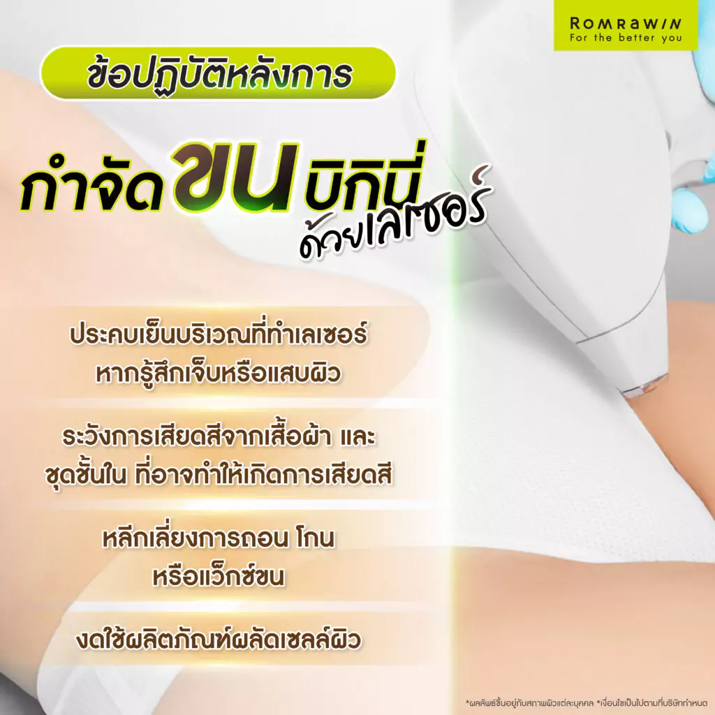 ข้อปฏิบัติหลังการกำจัดขนบิกินี่ด้วยเลเซอร์