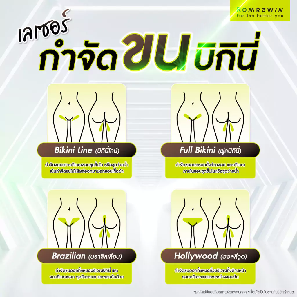 เลเซอร์กำจัดขนบิกินี่มีกี่รูปแบบ ? ต่างกันอย่างไร