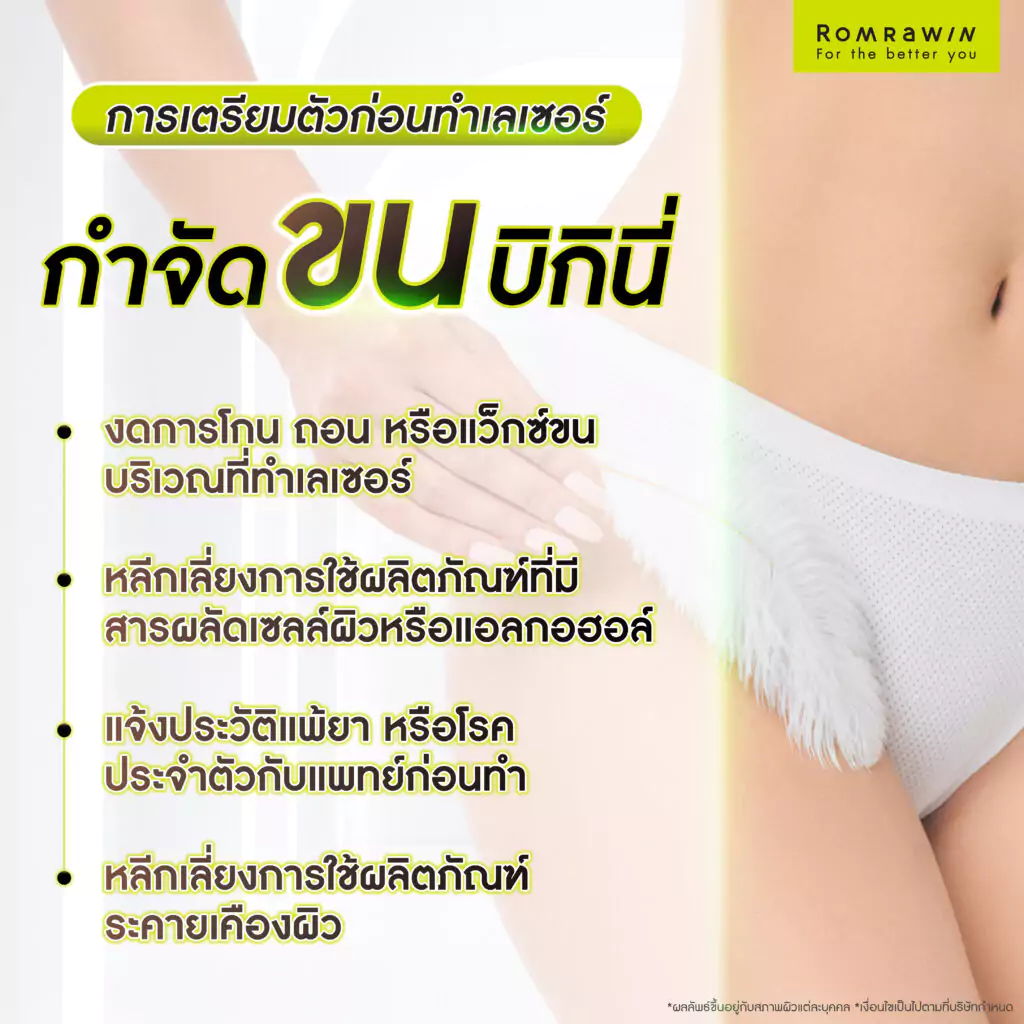 การเตรียมตัวก่อนทำเลเซอร์กำจัดขนบิกินี่