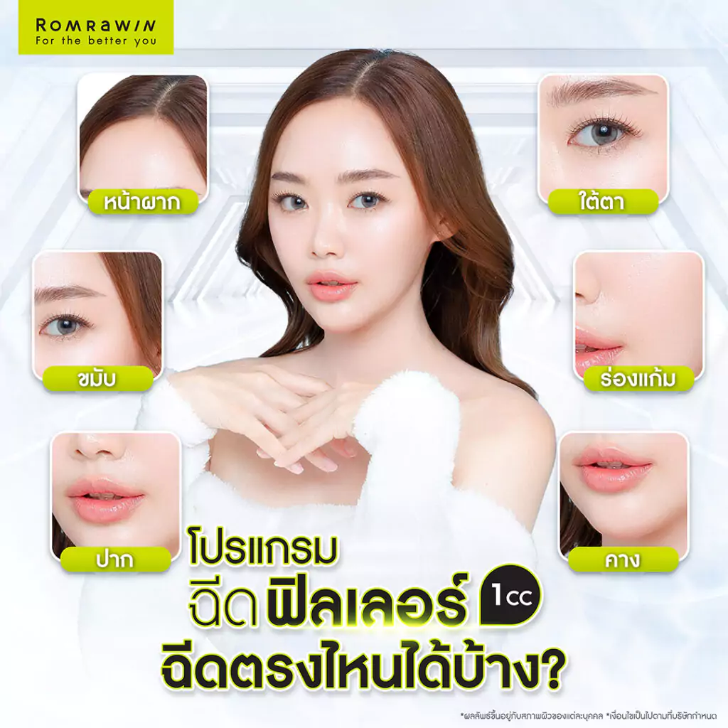 ฟิลเลอร์ 1 CC ฉีดตรงไหนได้บ้าง?