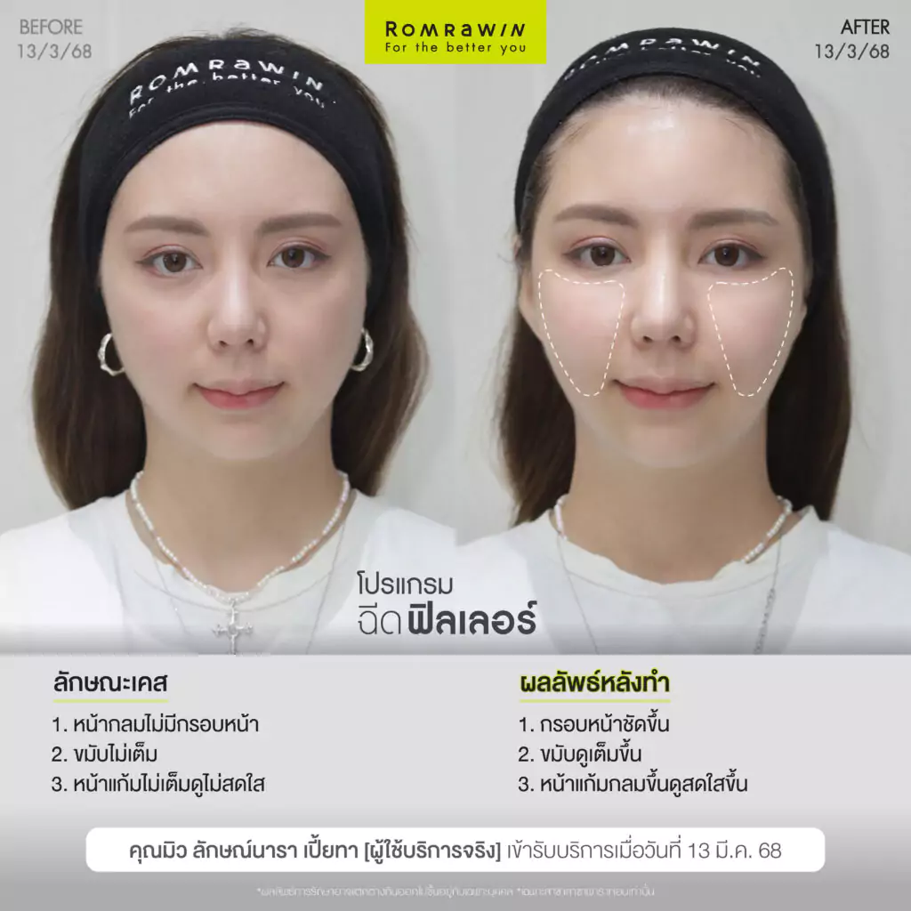 เติมนิด ปรับหน่อย หน้าละมุนแบบไม่โป๊ะคุณมิวลักษณ์นารา