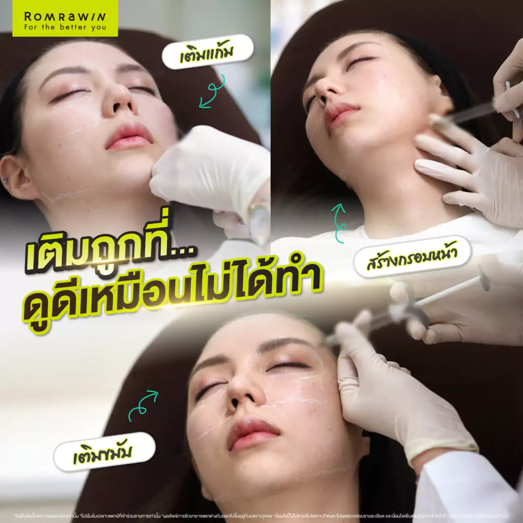 เติมนิด ปรับหน่อย หน้าละมุนแบบไม่โป๊ะคุณมิวลักษณ์นารา
