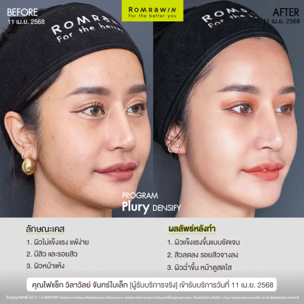 Plury Densify คุณไฟแช็ก