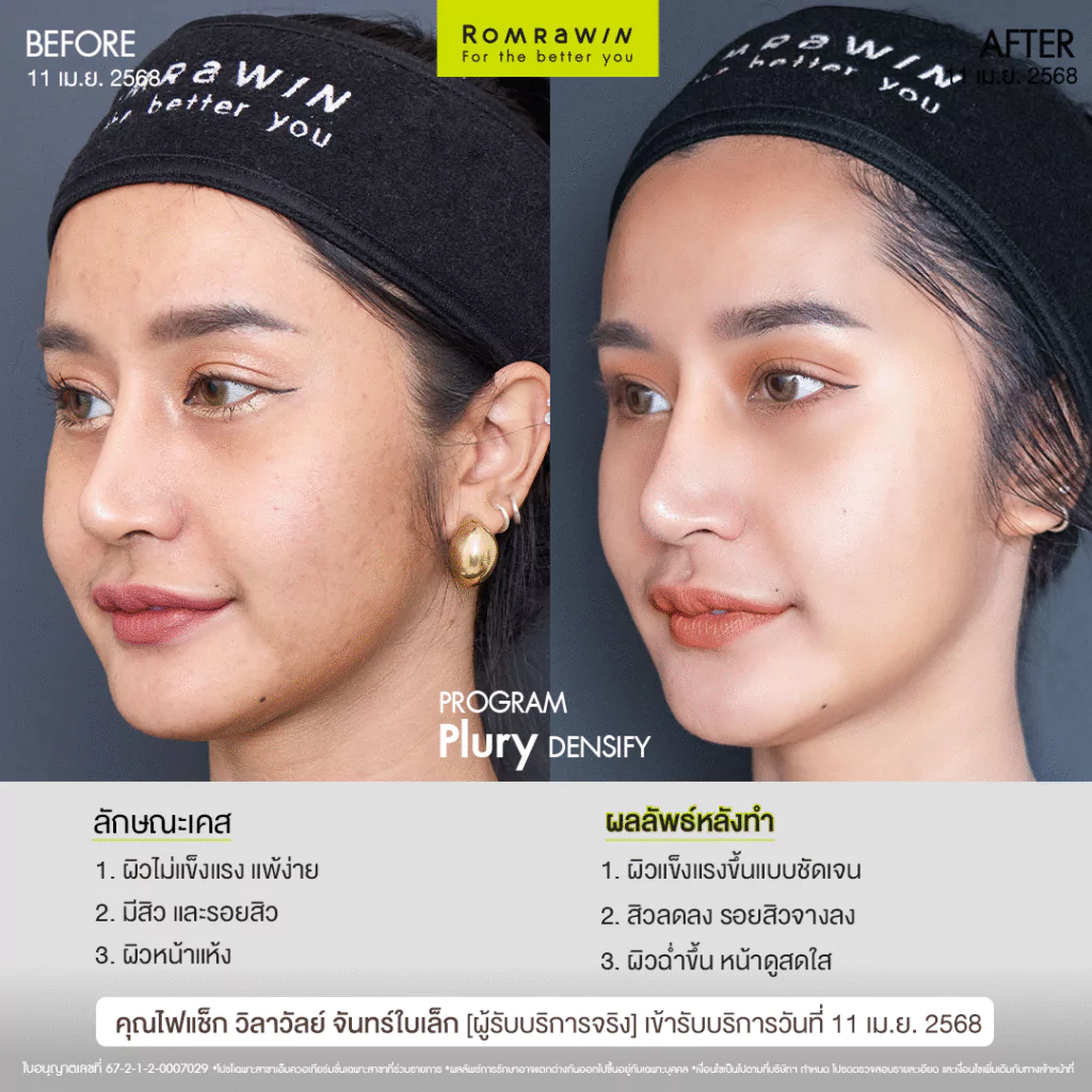 Plury Densify คุณไฟแช็ก
