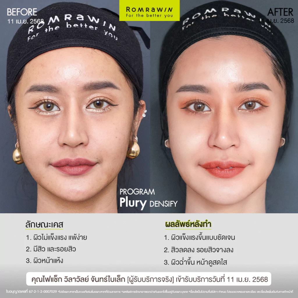 Plury Densify คุณไฟแช็ก