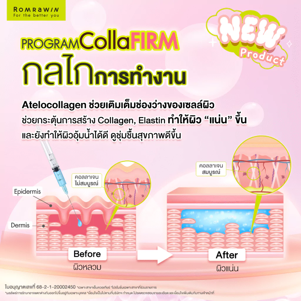 กลไกการทำงานของ Collaju