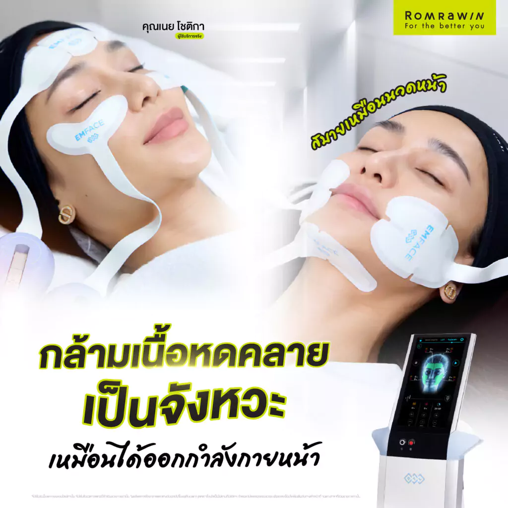 EMFACE คุณเนย โชติกา