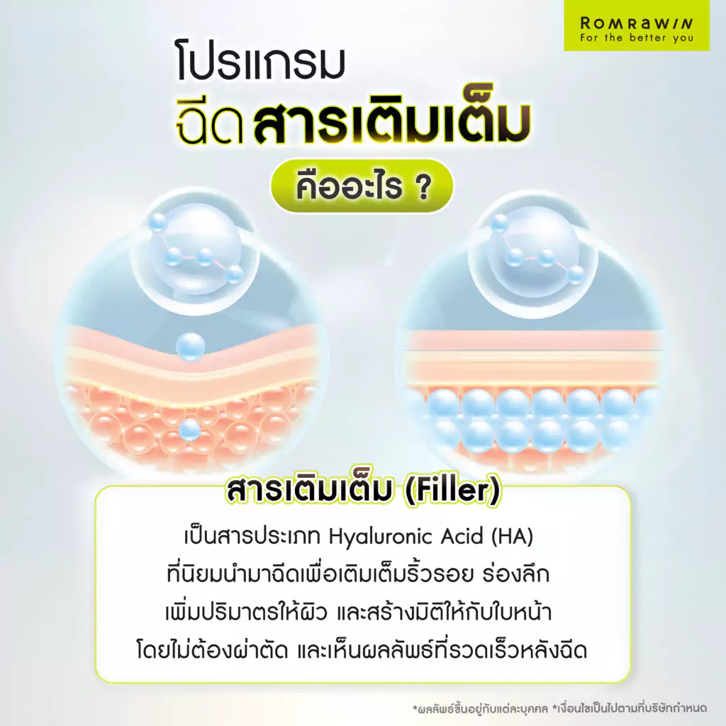 สารเติมเต็ม (Filler) คืออะไร?