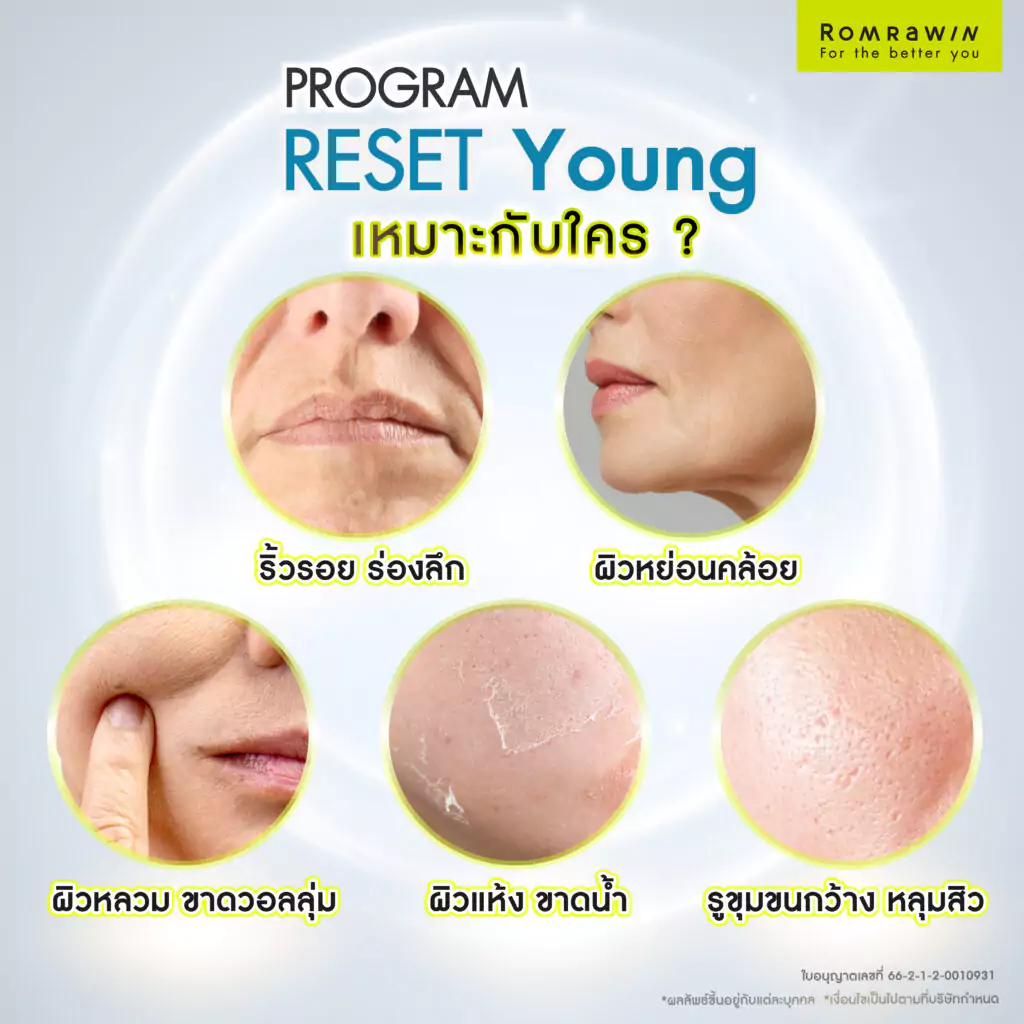 Radiesse Biostimulator เหมาะกับใคร?