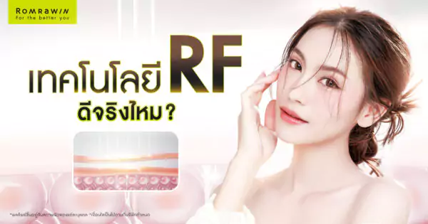 เทคโนโลยี RF (Radio Frequency)