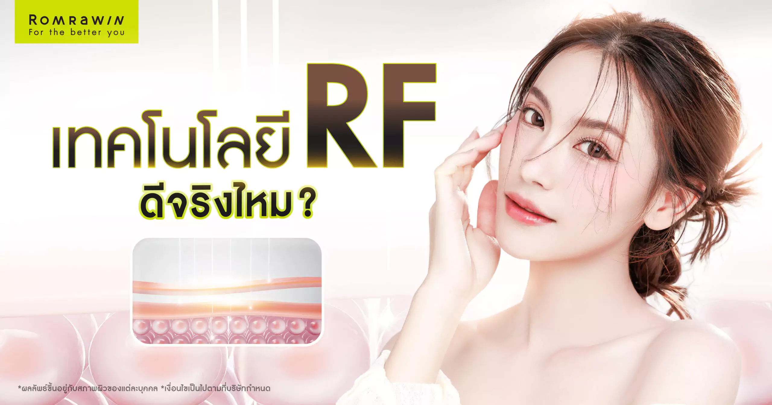 เทคโนโลยี RF (Radio Frequency)