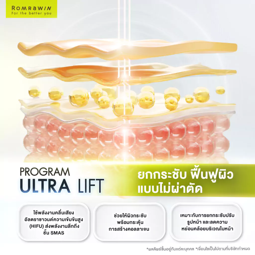ยกกระชับหน้า Ultra Lift คืออะไร?