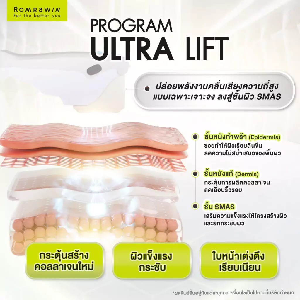 ยกกระชับหน้า Ultra Lift ทำงานอย่างไร?