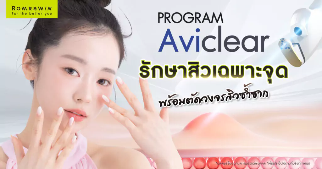 รักษาสิวเฉพาะจุด