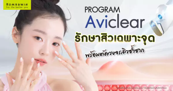 รักษาสิวเฉพาะจุด