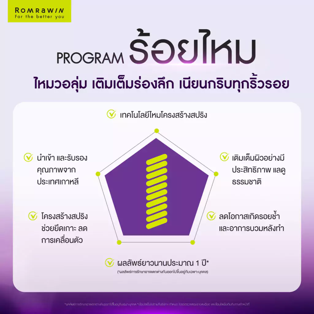 ข้อดีของไหม Epiticon