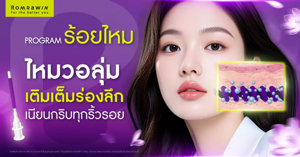 ไหม Epiticon