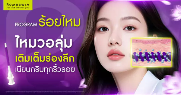 ไหม Epiticon