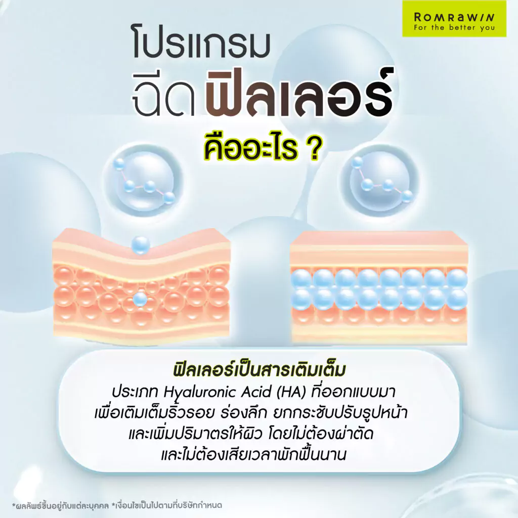 ฟิลเลอร์ คืออะไร?