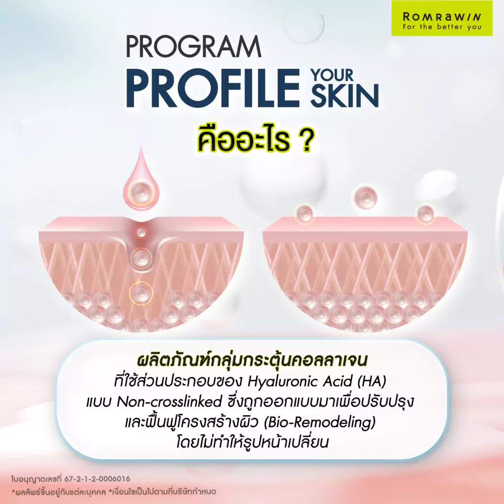 รู้จัก Profhilo กับ ฟิลเลอร์