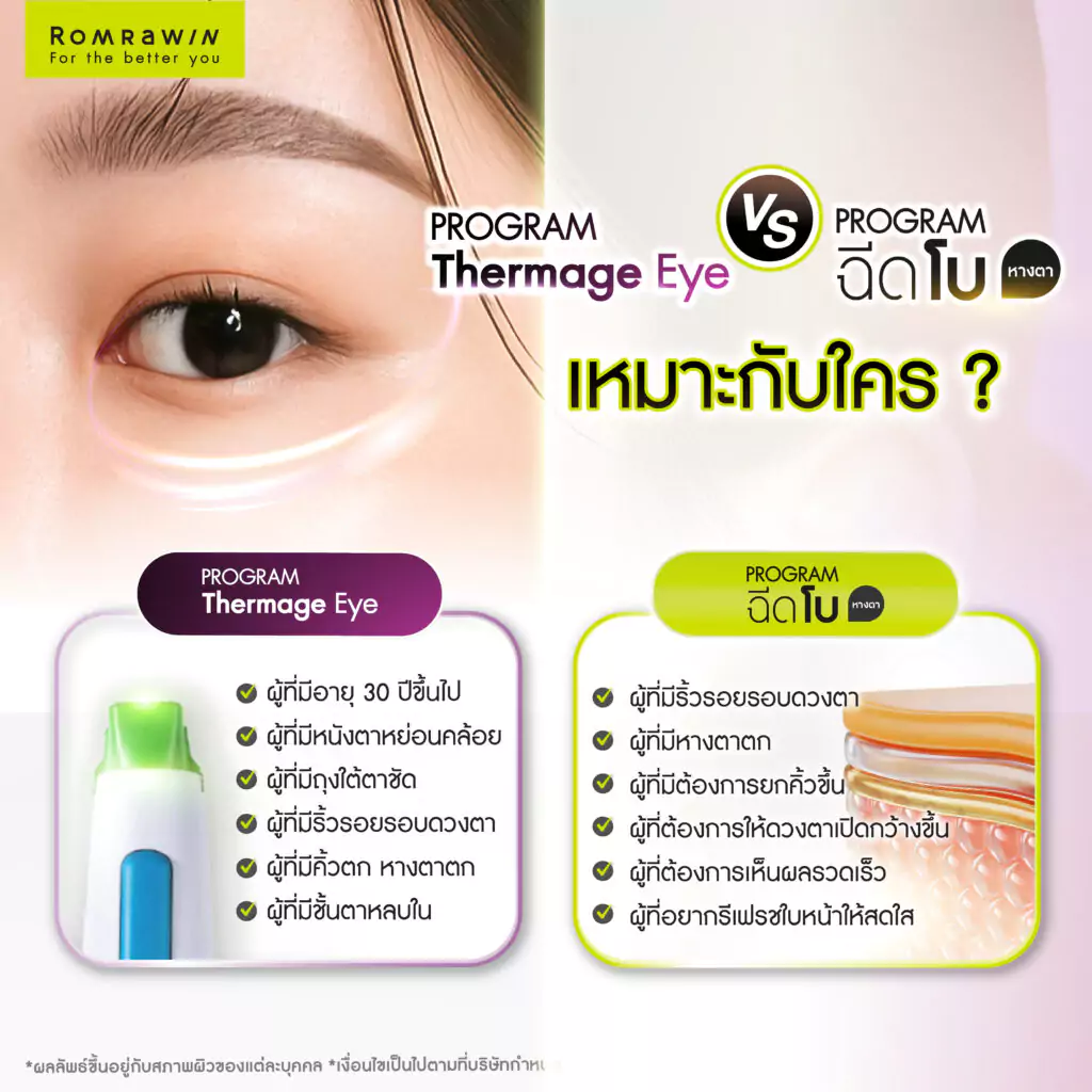 Thermage Eye และ โบหางตา เหมาะกับใคร?