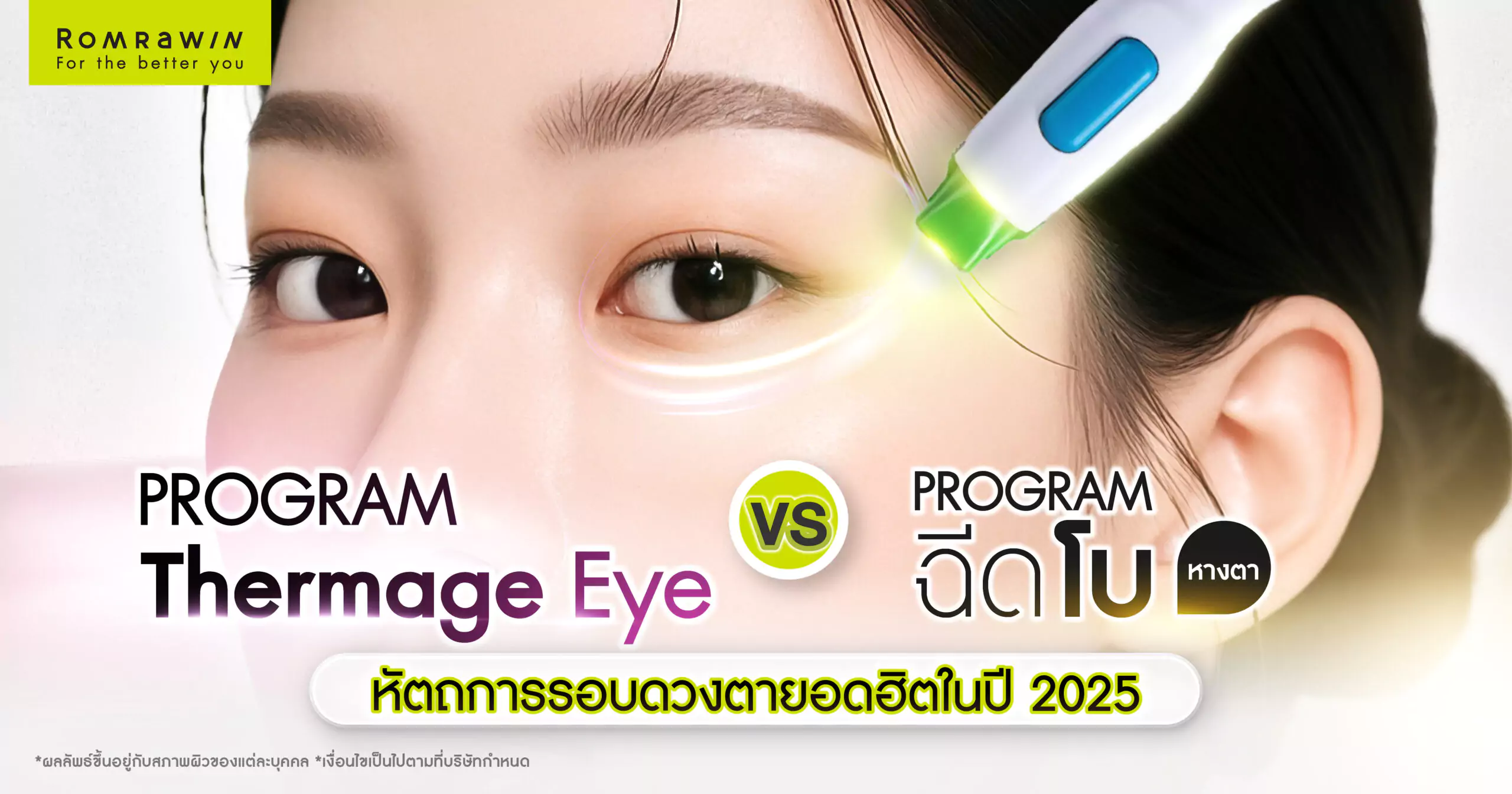 รอบดวงตา