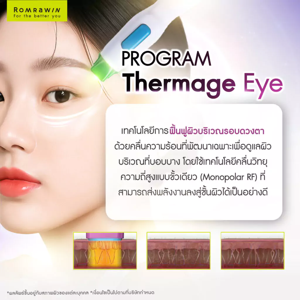 ทำความรู้จักกับ Thermage Eye และ โบหางตา