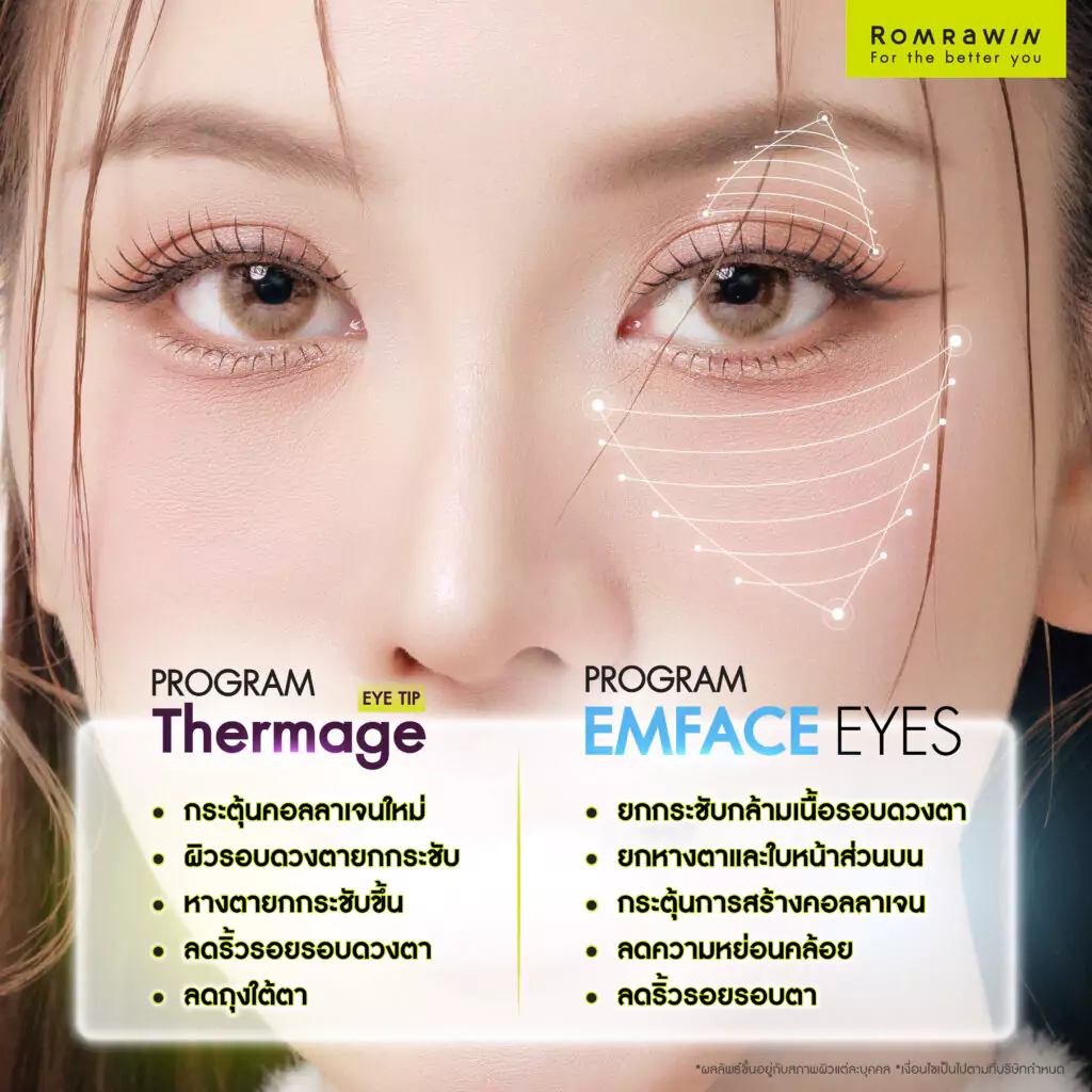 Thermage Eye และ EMFACE Eyes ช่วยอะไรบ้าง?