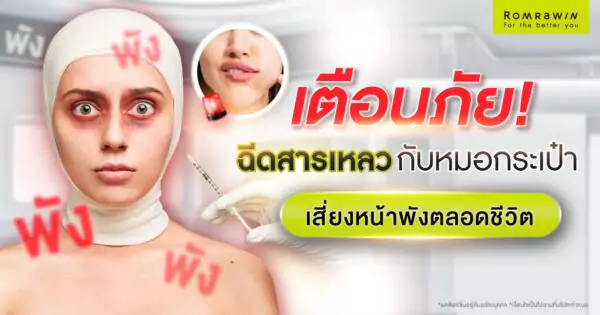 หมอกระเป๋า