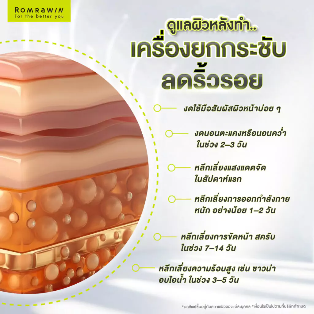 ดูแลผิวหลังทำเครื่องยกกระชับลดริ้วรอยอย่างไร ให้ริ้วรอยไม่กลับมาเร็ว?