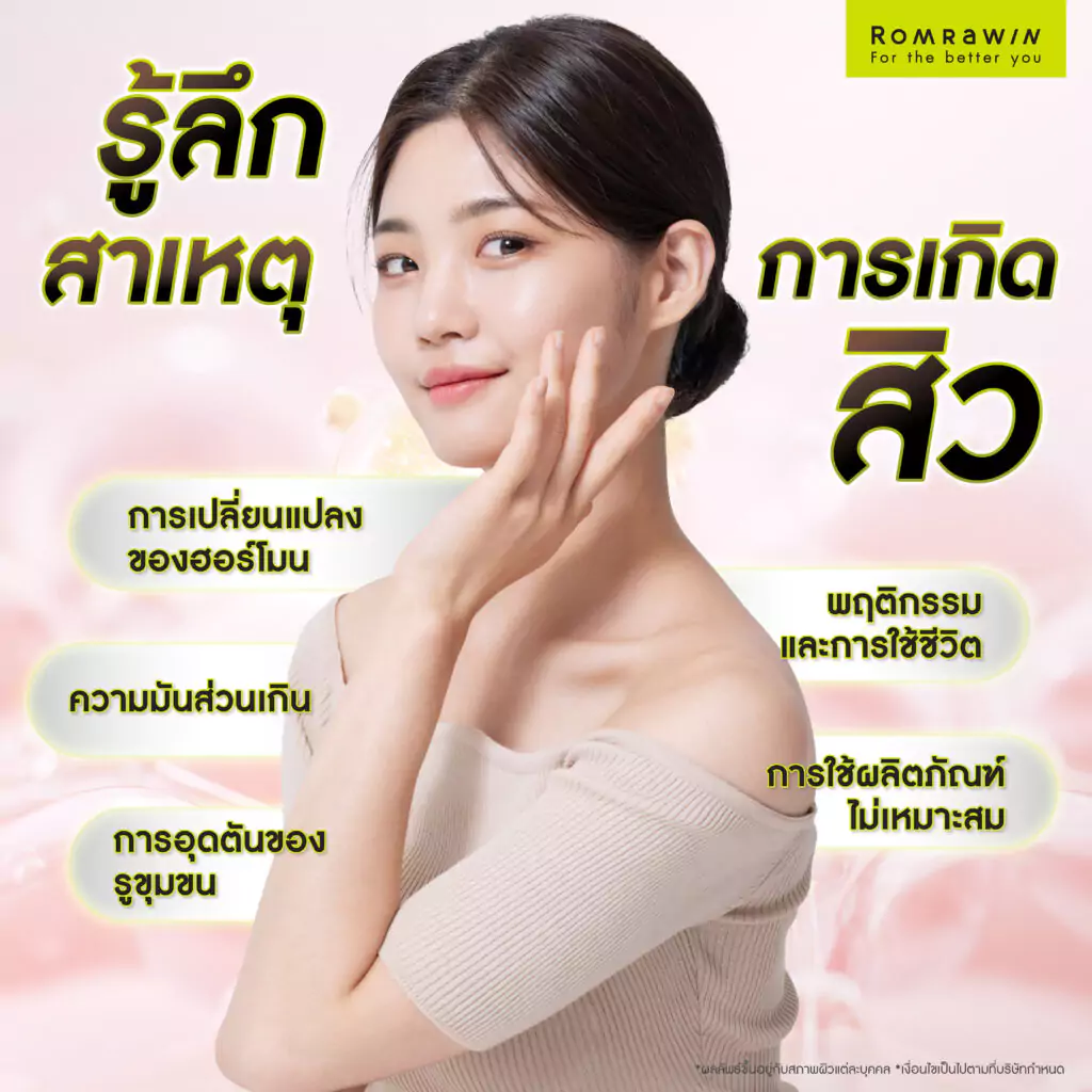 สาเหตุของการเกิดสิว