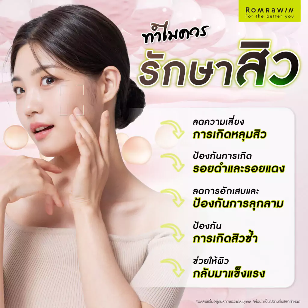 ทำไมควรรักษาสิว