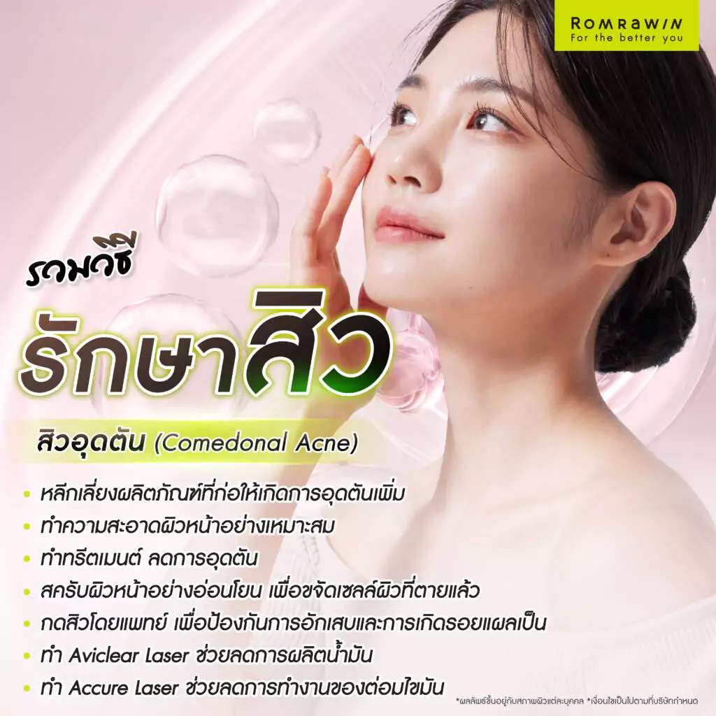 รวมวิธีรักษาสิวที่เหมาะกับสิวแต่ละประเภท 