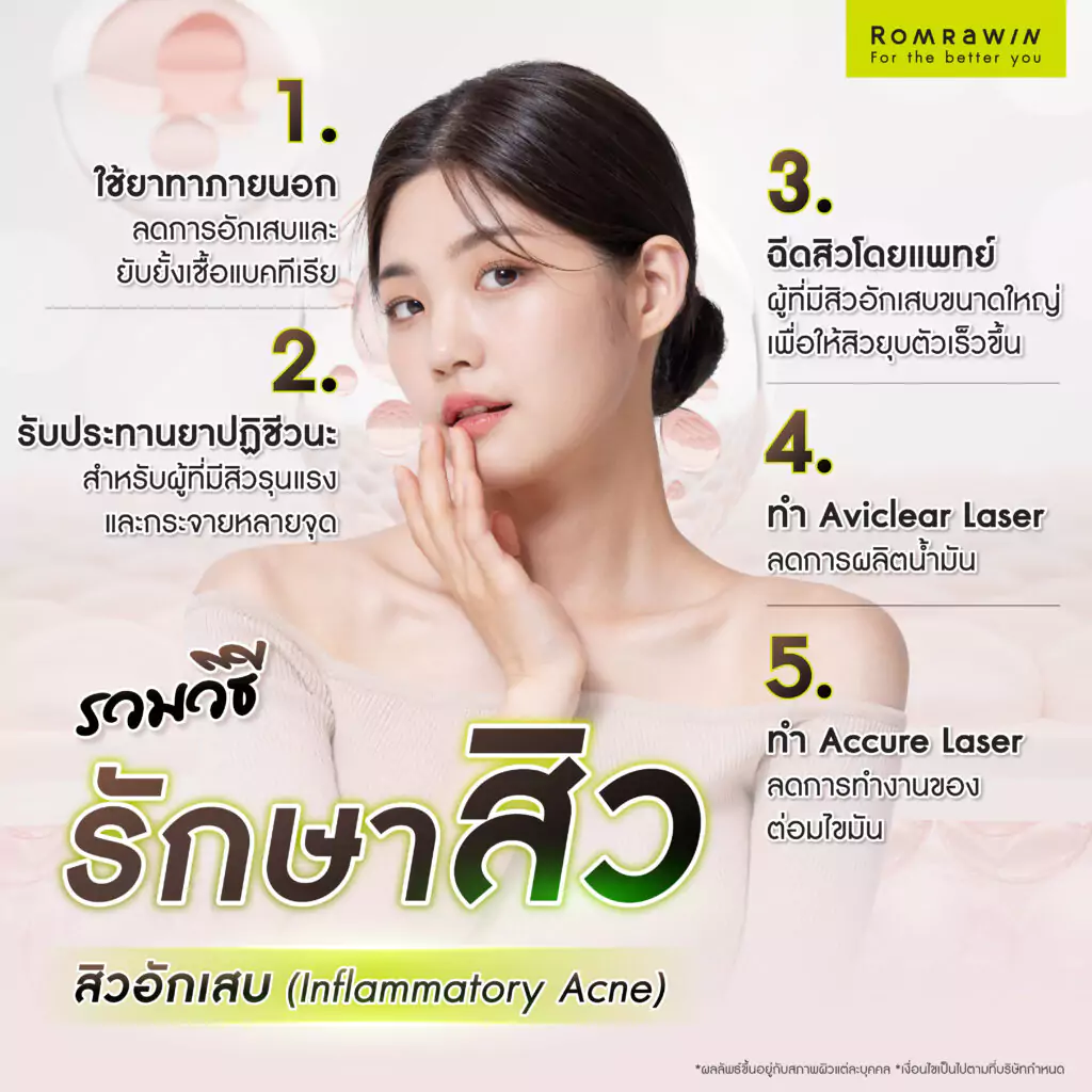 รวมวิธีรักษาสิวที่เหมาะกับสิวแต่ละประเภท 
