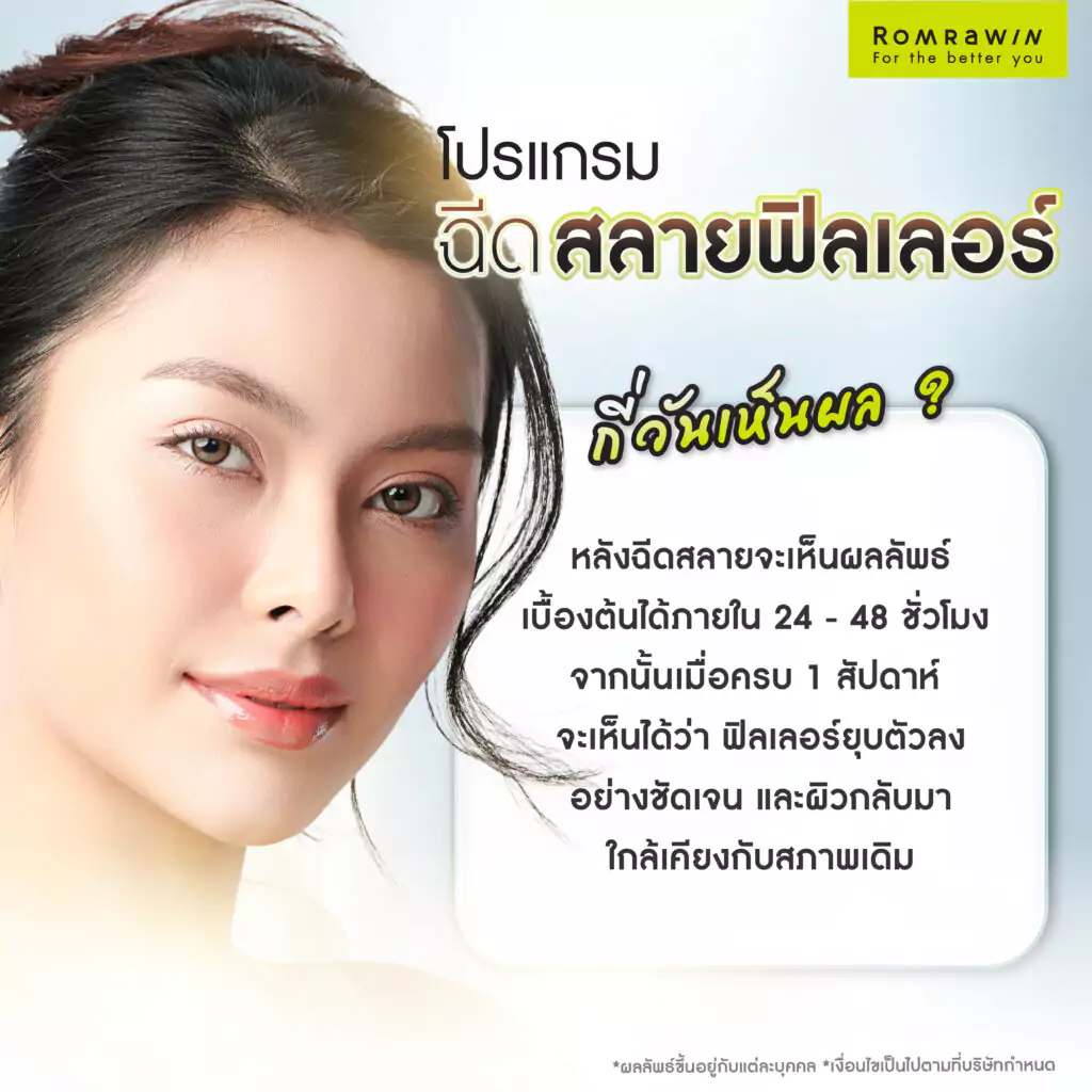 ฉีดสลายฟิลเลอร์ กี่วันเห็นผล?